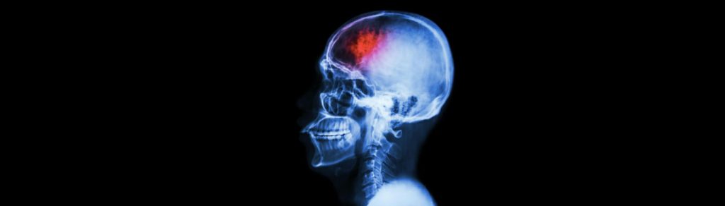 SEIZURES - Elumind Centres