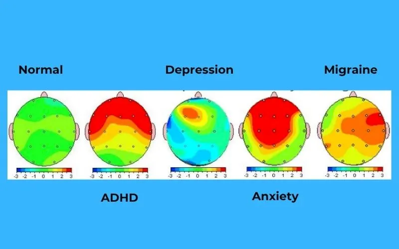 Mental health conditions